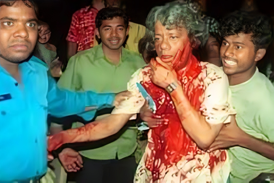 ড. হুমায়ুন আজাদের ওপর বর্বরোচিত হামলা ভয়াল ২১ আগস্ট ২০০৪ গ্রেনেড হামলার ঘটনা ও ছবি । ইতিহাস ও রাজনীতি সিরিজ 3 ড. হুমায়ুন আজাদের ওপর বর্বরোচিত হামলা