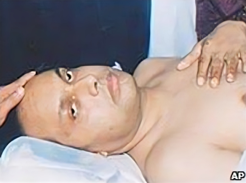 ব্রিটিশ হাইকমিশনার আনোয়ার চৌধুরীর ওপর গ্রেনেড হামলা ভয়াল ২১ আগস্ট ২০০৪ গ্রেনেড হামলার ঘটনা ও ছবি । ইতিহাস ও রাজনীতি সিরিজ 5 ব্রিটিশ হাইকমিশনার আনোয়ার চৌধুরীর ওপর গ্রেনেড হামলা